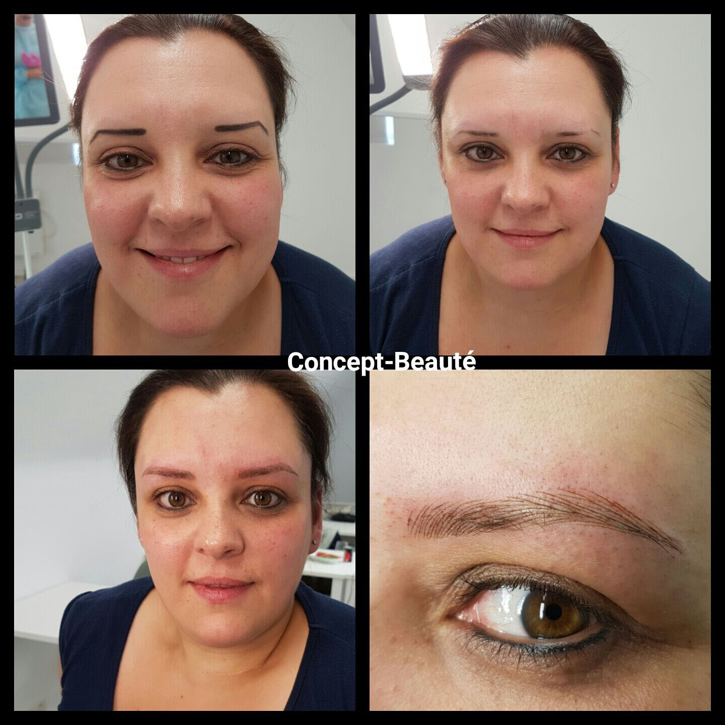 Microblading