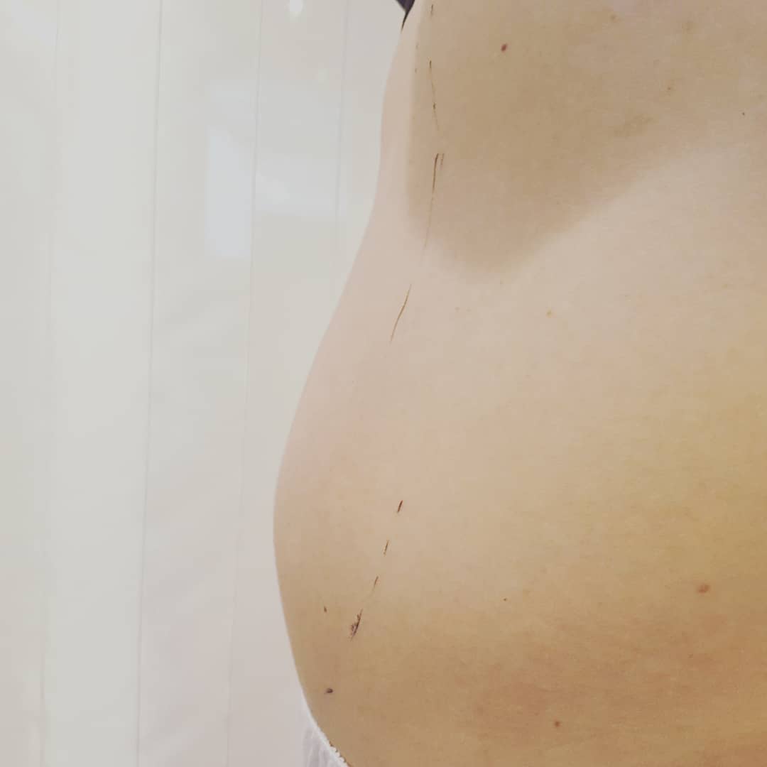 Microblading